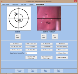 biopsymarking 600x569